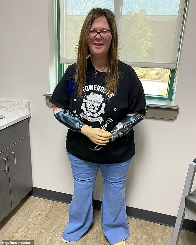 Septic Shock from Flu Leads to Limb Loss in North Carolina Mother