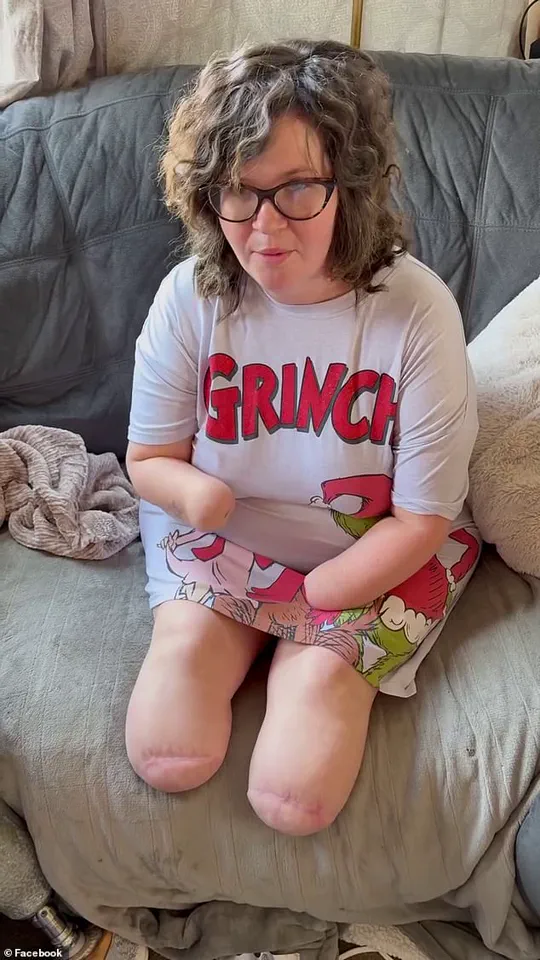 Septic Shock from Flu Leads to Limb Loss in North Carolina Mother