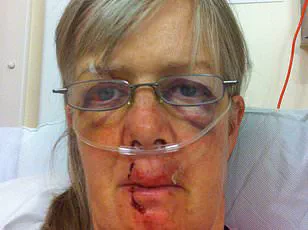 Dog Walker Climbs Tree for Hour After Cow Charge, Firefighters Called to Isle of Wight