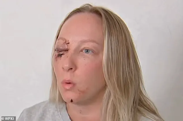 Pennsylvania Mother Narrowly Escapes Death After Ice Slab Shatters Windshield on Parkway West