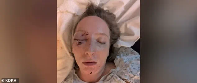 Pennsylvania Mother Narrowly Escapes Death After Ice Slab Shatters Windshield on Parkway West