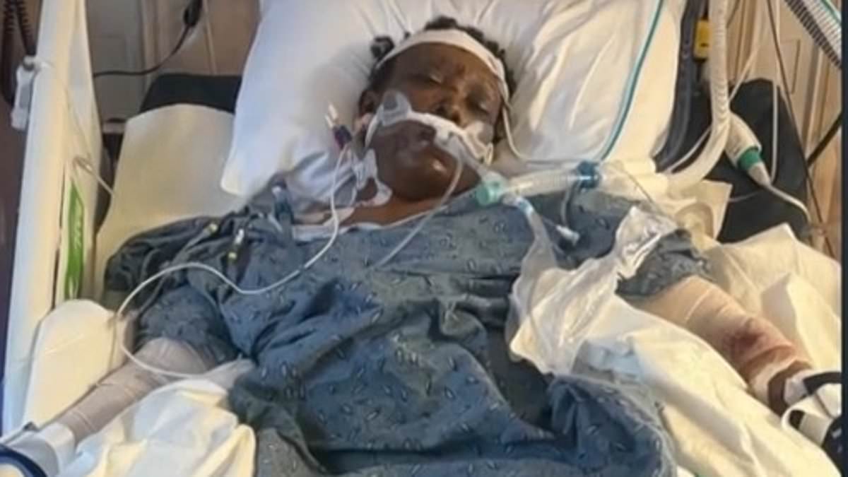 Holly Springs Mother Survives Brutal Dog Attack with Severe Injuries
