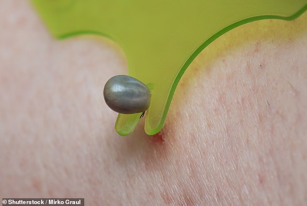 Tick bite ER visits surge in Northeast, doubling national averages