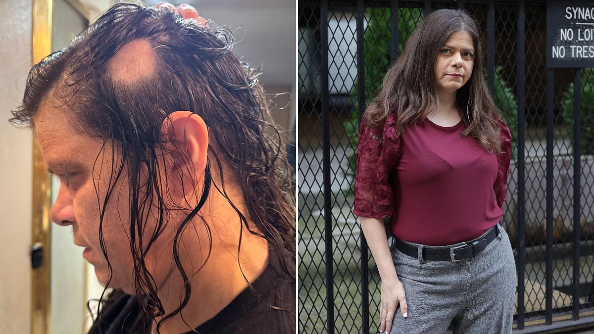 Woman Finds Relief From Hair Loss With Simple Rosemary Shampoo