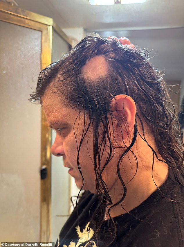 Woman Finds Relief From Hair Loss With Simple Rosemary Shampoo