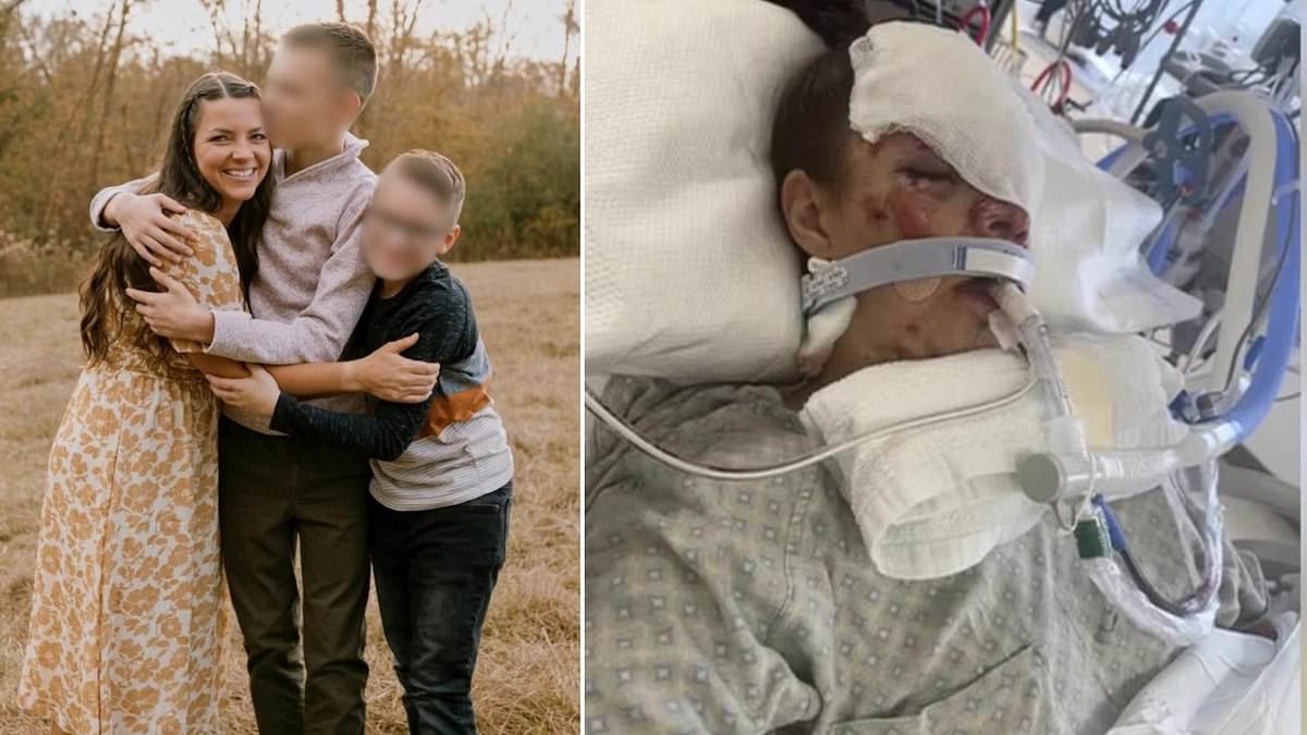 Kenai mother reveals devastating injuries eight months after grizzly bear mauling.