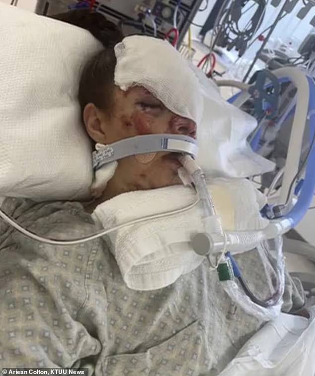 Kenai mother reveals devastating injuries eight months after grizzly bear mauling.