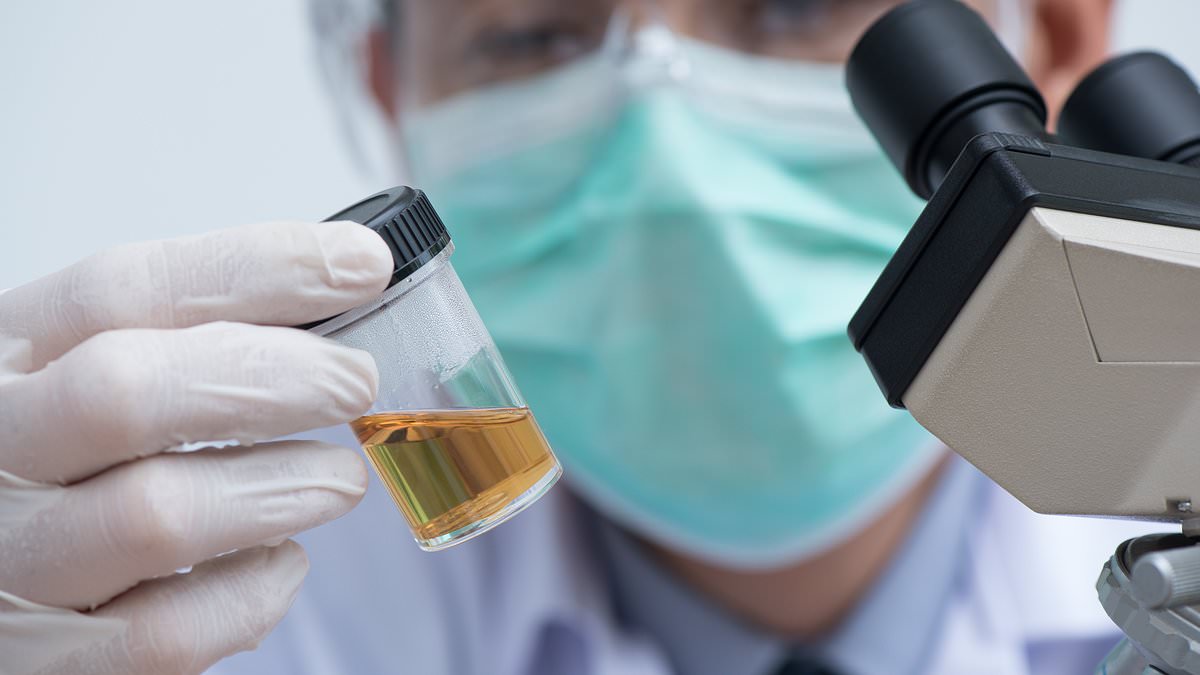 New urine test could detect lung cancer years before symptoms appear.