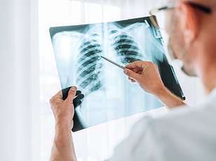 New urine test could detect lung cancer years before symptoms appear.