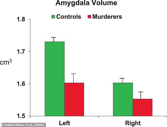 Premeditated Killers Show 14.3% Smaller Amygdala in New Brain Scan Study