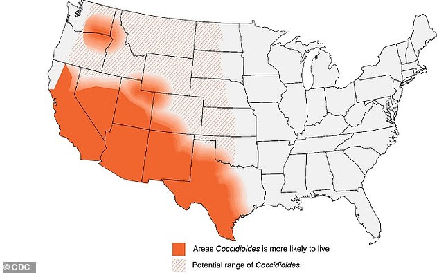 Deadly fungal storms threaten 11 US states with Valley fever surge this summer.