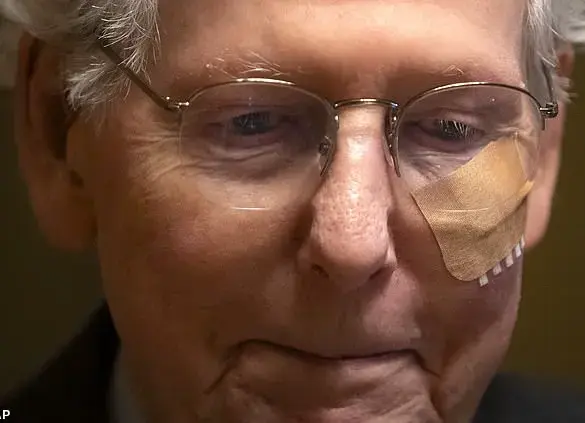 Mitch McConnell experiences multiple falls on Capitol Hill