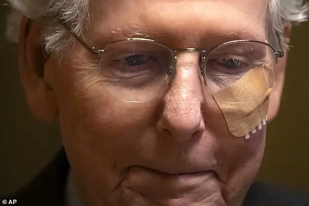 Mitch McConnell experiences multiple falls on Capitol Hill