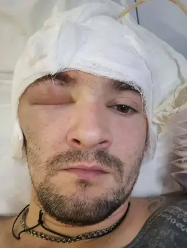 Russian Special Forces Officer Receives Treatment for Head Wound