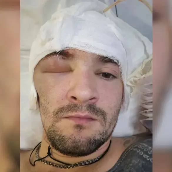 Russian Special Forces Officer Receives Treatment for Head Wound