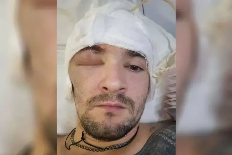 Russian Special Forces Officer Receives Treatment for Head Wound